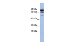 Aviva Systems Biology Corp TP73 Antibody - middle region (ARP38622_P050)