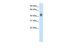 Aviva Systems Biology Corp SOX3 Antibody - N-terminal region (ARP38648_T100)