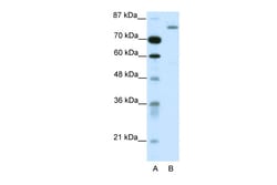 Aviva Systems Biology Corp TRIM28 Antibody - C-terminal region (ARP38681_T100)