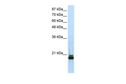 Aviva Systems Biology Corp SAP18 Antibody - N-terminal region (ARP38690_P050)