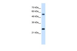 Aviva Systems Biology Corp SMAD1 Antibody - N-terminal region (ARP38692_T100)