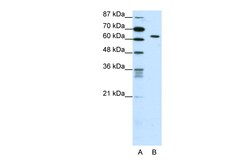 Aviva Systems Biology Corp SMAD1 Antibody - C-terminal region (ARP38693_T100)