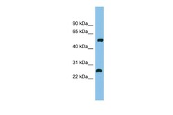 Aviva Systems Biology Corp MEF2D Antibody - middle region (ARP38699_P050)