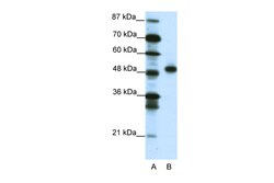 Aviva Systems Biology Corp MEOX2 Antibody - C-terminal region (ARP38701_T100)