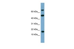Aviva Systems Biology Corp TSC22D1 Antibody - middle region (ARP38726_P050)