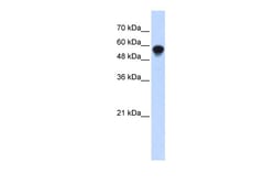 Aviva Systems Biology Corp IRF6 Antibody - middle region (ARP38739_P050)