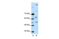 Aviva Systems Biology Corp PEG3 Antibody - C-terminal region (ARP38756_P050)