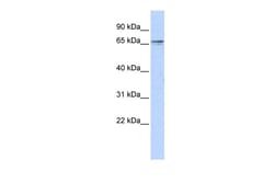 Aviva Systems Biology Corp ZNF192 Antibody - middle region (ARP38775_P050)