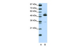 Aviva Systems Biology Corp TADA3L Antibody - C-terminal region (ARP38786_P050)