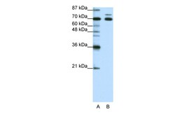 Aviva Systems Biology Corp TRIM16 Antibody - N-terminal region (ARP38799_T100)