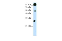 Aviva Systems Biology Corp CTCF Antibody - N-terminal region (ARP38820_P050)