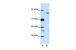 Aviva Systems Biology Corp LZTR1 Antibody - C-terminal region (ARP38863_T100)