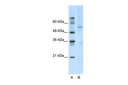 Aviva Systems Biology Corp ATF7 Antibody - C-terminal region (ARP38869_T100)