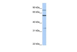 Aviva Systems Biology Corp ZNF16 Antibody - C-terminal region (ARP38885_P050)