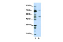 Aviva Systems Biology Corp CORO1A Antibody - N-terminal region (ARP38899_T100)