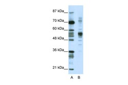 Aviva Systems Biology Corp CORO1A Antibody - C-terminal region (ARP38900_T100)