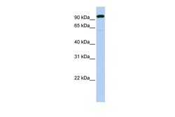 Aviva Systems Biology Corp ZNF175 Antibody - N-terminal region (ARP38910_P050)