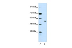 Aviva Systems Biology Corp BRD3 Antibody - N-terminal region (ARP38939_T100)