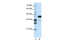 Aviva Systems Biology Corp TARDBP Antibody - N-terminal region (ARP38941_T100)