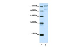 Aviva Systems Biology Corp AATF Antibody - N-terminal region (ARP38957_T100)