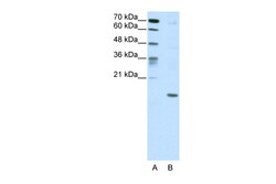Aviva Systems Biology Corp DUX5 Antibody - C-terminal region (ARP38960_T100)
