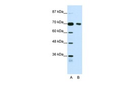 Aviva Systems Biology Corp TRIM32 Antibody - N-terminal region (ARP38965_T100)