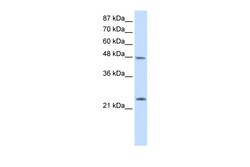 Aviva Systems Biology Corp CBX6 Antibody - N-terminal region (ARP39073_T100)