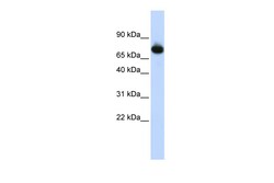 Aviva Systems Biology Corp PATZ1 Antibody - middle region (ARP39078_P050)