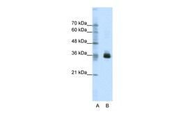 Aviva Systems Biology Corp OTX1 Antibody - C-terminal region (ARP39103_T100)