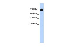 Aviva Systems Biology Corp CXXC1 Antibody - C-terminal region (ARP39110_T100)