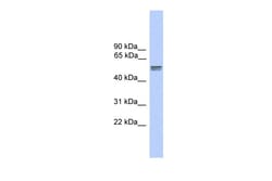 Aviva Systems Biology Corp CDR2L Antibody - N-terminal region (ARP39113_P050)