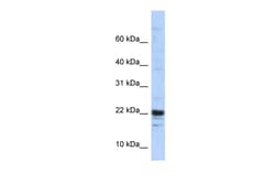 Aviva Systems Biology Corp KIAA0040 Antibody - middle region (ARP39121_P050)