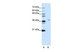 Aviva Systems Biology Corp SART3 Antibody - N-terminal region (ARP39128_T100)
