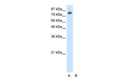 Aviva Systems Biology Corp TSC22D2 Antibody - N-terminal region (ARP39137_P050)