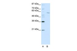 Aviva Systems Biology Corp RCOR1 Antibody - C-terminal region (ARP39179_P050)