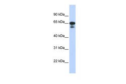 Aviva Systems Biology Corp MIZF Antibody - middle region (ARP39196_P050)