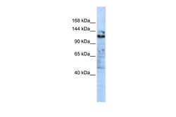 Aviva Systems Biology Corp ZNF451 Antibody - C-terminal region (ARP39198_P050)