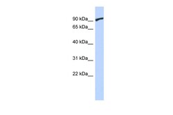 Aviva Systems Biology Corp ZNF337 Antibody - middle region (ARP39204_P050)