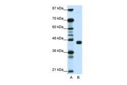 Aviva Systems Biology Corp PPARG Antibody - N-terminal region (ARP39207_T100)