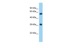 Aviva Systems Biology Corp Zbtb7a Antibody - C-terminal region (ARP39212_P050)