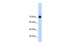 Aviva Systems Biology Corp GTF2IRD1 Antibody - C-terminal region (ARP39254_T100)