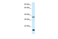Aviva Systems Biology Corp Klf3 Antibody - C-terminal region (ARP39264_P050)