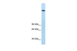 Aviva Systems Biology Corp JMJD1B Antibody - C-terminal region (ARP39268_T100)