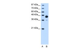 Aviva Systems Biology Corp HOXC10 Antibody - N-terminal region (ARP39274_P050)