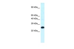 Aviva Systems Biology Corp Hoxb9 Antibody - C-terminal region (ARP39275_P050)