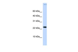 Aviva Systems Biology Corp CHRAC1 Antibody - middle region (ARP39281_P050)