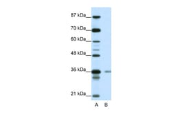Aviva Systems Biology Corp HIF1AN Antibody - N-terminal region (ARP39316_P050)