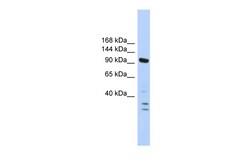 Aviva Systems Biology Corp PBRM1 Antibody - N-terminal region (ARP39331_P050)