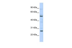 Aviva Systems Biology Corp HOXC5 Antibody - N-terminal region (ARP39378_P050)