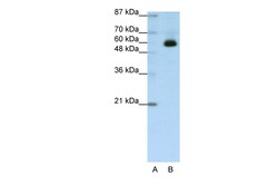 Aviva Systems Biology Corp ZNF307 Antibody - C-terminal region (ARP39385_T100)